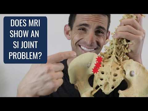 Does MRI Show an SI Joint Problem?