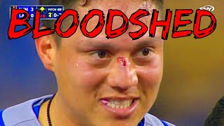 MLB Bloodshed
