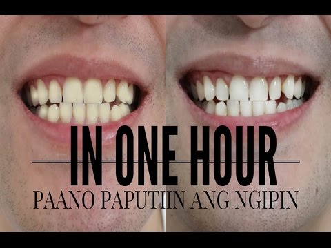 Kahit na pagbaba ng timbang nang malaki-laki sa pamamagitan ng 5 kg Calorie taba sa bawat 100 g
