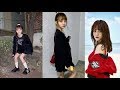 AOA S Jimin Plastic Surgery Or Weight Loss