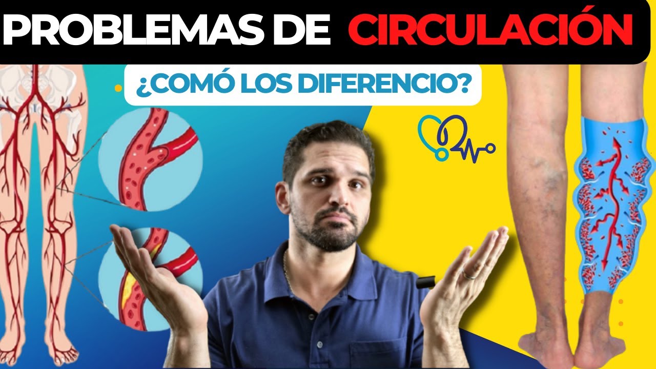 ¿comó SABER si tengo problemas CIRCULACIÓN?➡Estos  son los SÍNTOMAS 😲