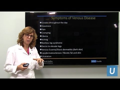 Latex de la varicoză
