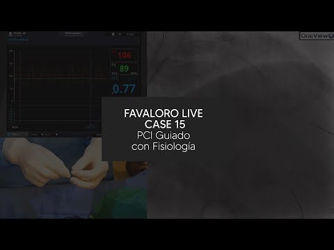 Favaloro Live Case N° 15 - PCI Guiado con Fisiología