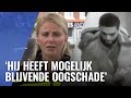 Man met glas in gezicht geslagen in nachtclub