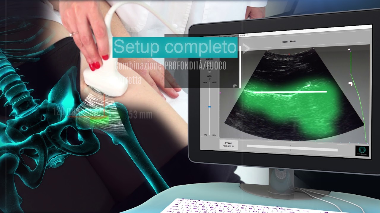 EchoS Scansione Femore - VOCE