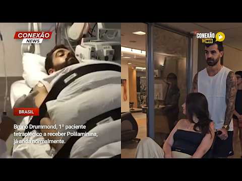 Vídeo: Bruno Drummond, 1º paciente tetraplégico a receber Polilaminina, já anda normalmente.