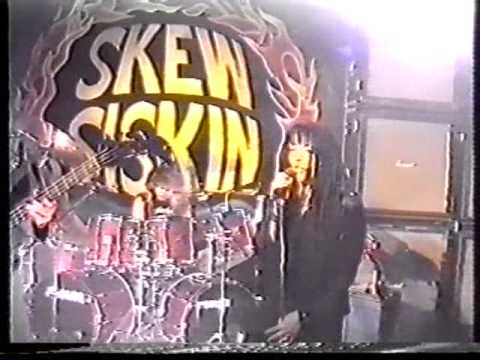 Skew Siskin Docu Part 1 the 90s