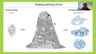 Neuropathology on tape – applications of ATUM-based volume EM