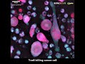 T Cells Killing Cancer Cells