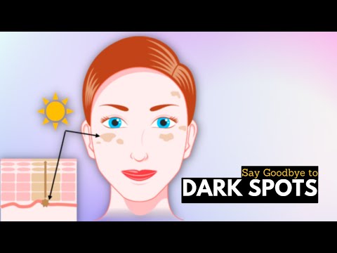 Say Goodbye To Dark Spots On Your Face With These Tips And Tricks