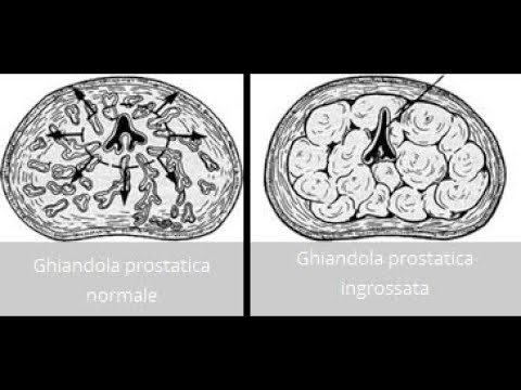 gyógyszer Bacterfort valódi vélemények