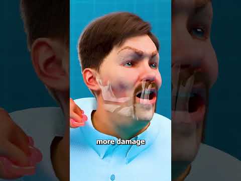 How Brass Knuckles Work 🤔