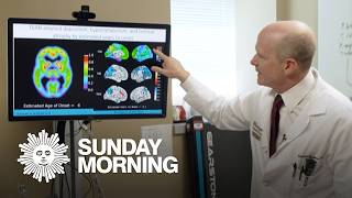 Alzheimer's and dementia