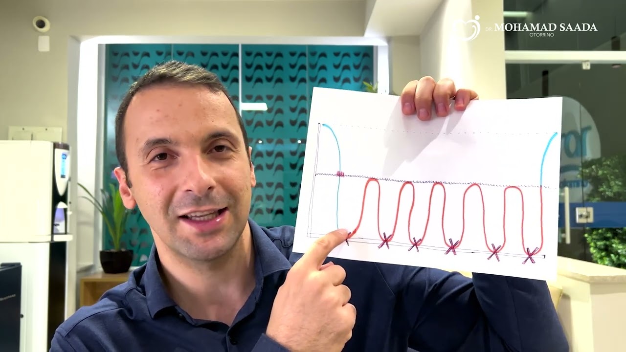 Ronco e Apneia. Quais os Riscos, Diagnósticos, Tratamentos e Curiosidades