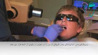 رادیوگرافی دندانپزشکی | دندانپزشکی سیمادنت