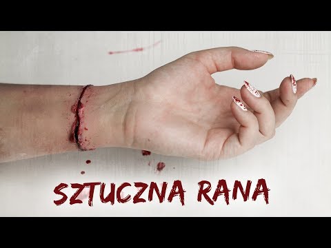 Chirurgia kości na duże koszty toe Ooo koślawy i hallyuks Niemcy