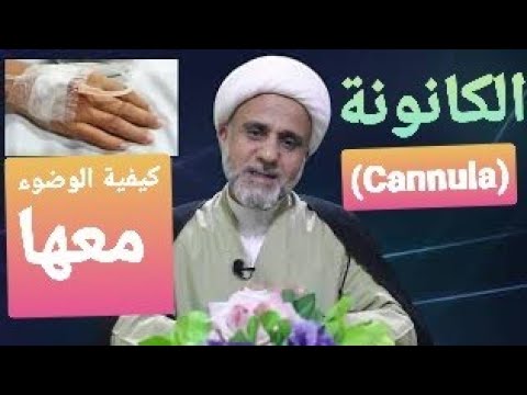 ⁣ماحكم الكانونة في اليد/الوضوء ام التيمم / ام كلاهما معا