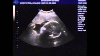 PARA TI YESHUA ALEXANDER VILLEGAS VALLEJO