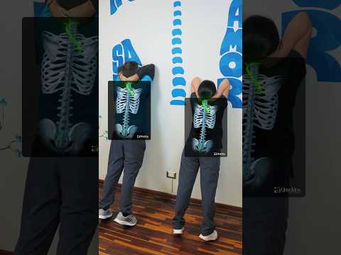 ¿Dolor de espalda? 💢 #dolordeespalda #dolorlumbar #estiramiento #ejercicio