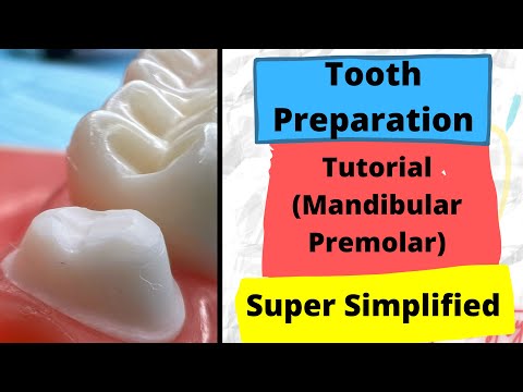 Crown Preparation TIPS and TRICKS - Mandibular Premolar (Zirconia crown)
