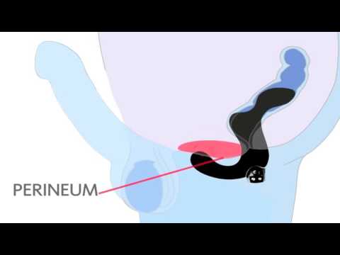 Chronische Prostatitis simtomy. Academic Prostata Ultraschall