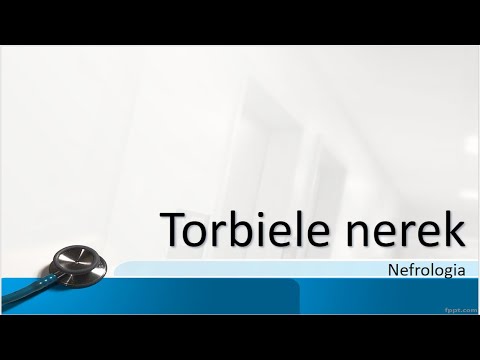 Torbiele nerek: przyczyny, objawy, rodzaje, leczenie