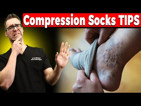 2nd YouTube video about are compression socks good for varicose veins