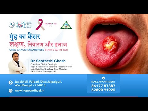 The Silent Danger: Complete Oral Cancer Guide | Dr. Saptarshi Ghosh | Hope & Heal