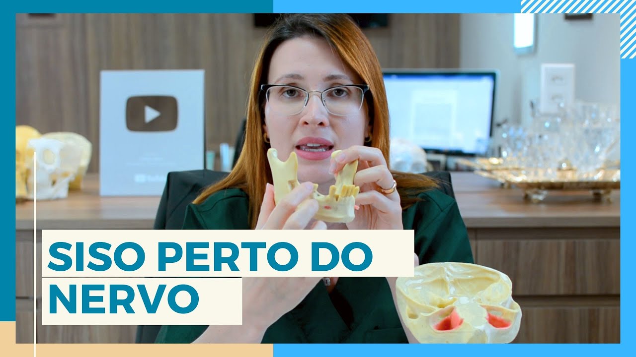 CORONECTOMIA DO SISO PERTO DO NERVO - DRA. DANIELLE SALES