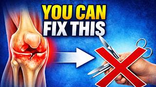 Most Meniscus Tears Don’t Need Surgery (Do This Instead)