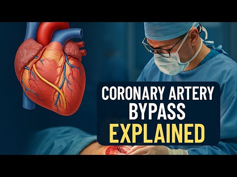 MD Talk Procedures: Coronary Artery Bypass Graft - Delving into Heart Surgery