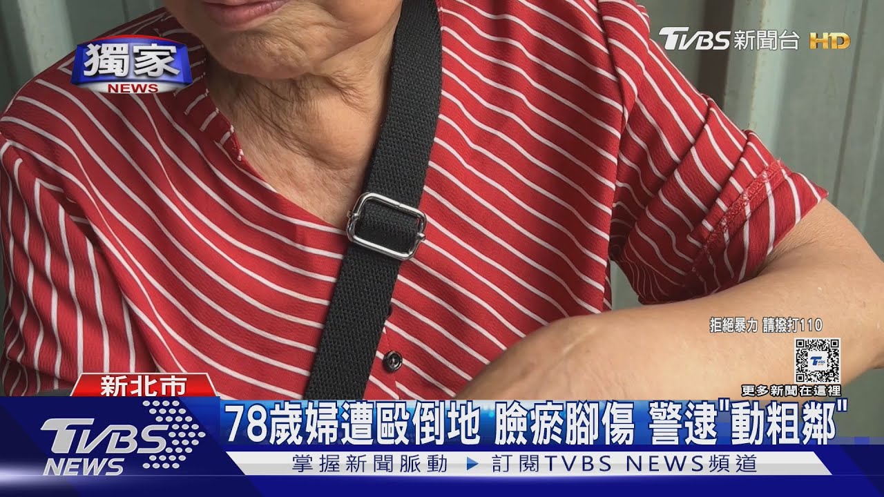 擋到我啦!鄰為「停車」鬧翻 婦遭摑臉摔慘