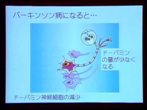 [youtube] iPS 再生医療「iPS細胞を用いたパーキンソン病治療」高橋 淳