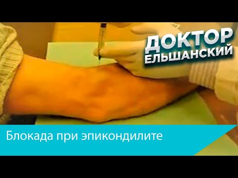 Как лечить остеоартроз тазобедренного сустава 3 степени После поднятия тяжести болит низ живота и поясница у женщин