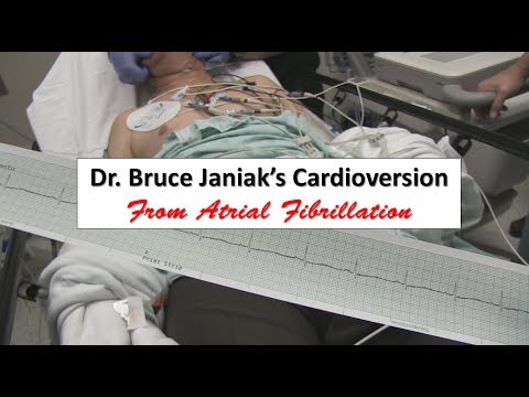 Dr. Bruce Janiak's Cardioversion from Atrial Fibrillation