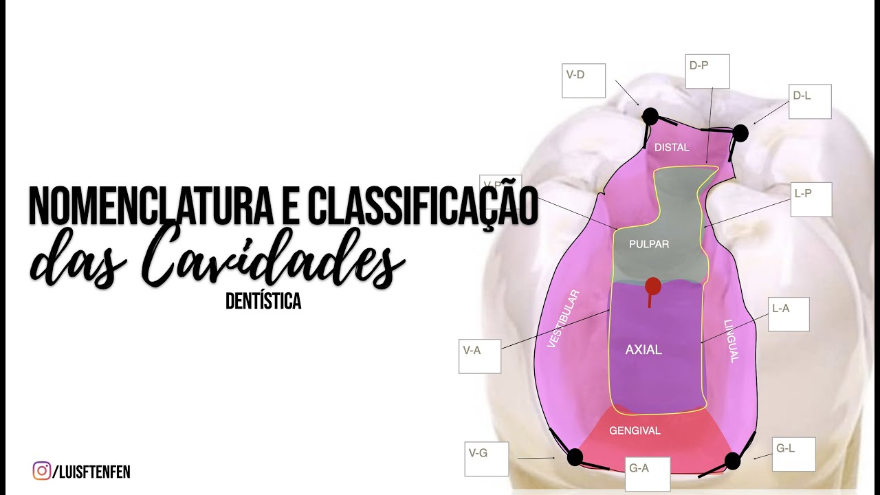 Classificação e Nomenclatura das Cavidades