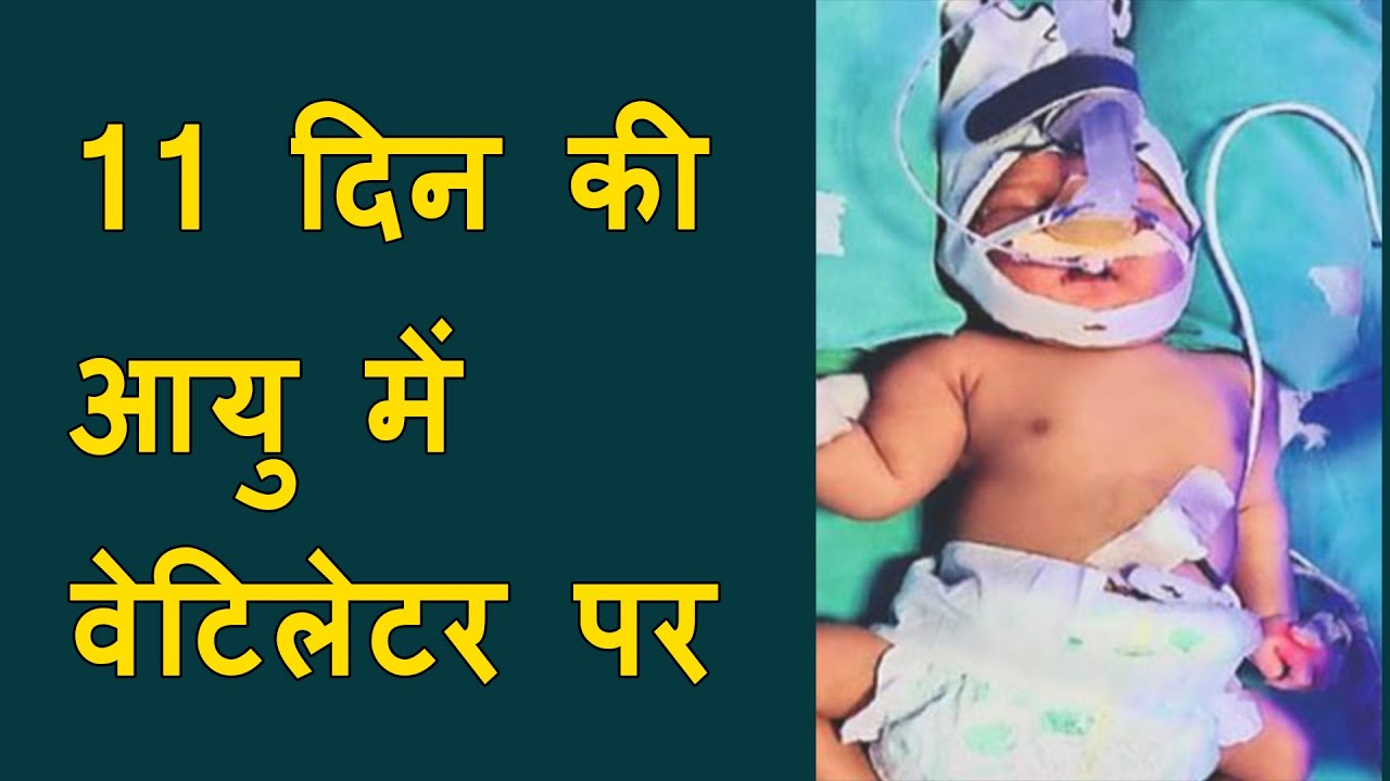 11 day baby on ventilator in surat | 11 day baby corona positive and had remdesivir dose, SURAT NEWS