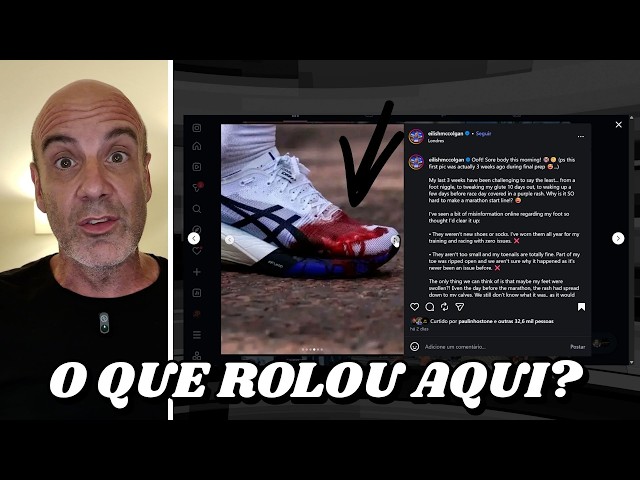 O que ACONTECEU com o PÉ DELA?