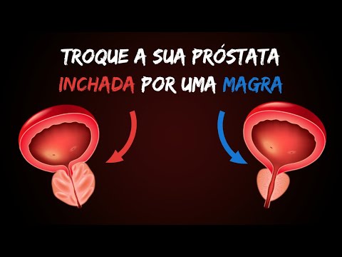 Cancer la prostata cu metastaza osoasa