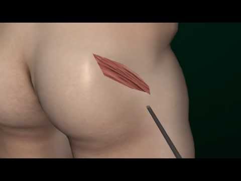 Mal di schiena a causa livello del cuore X-ray fotografia del collo dellutero osteocondrosi