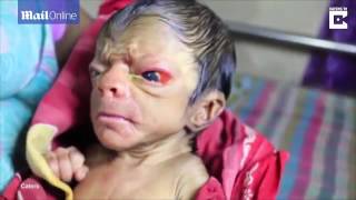 MUST WATCH! A New Born Baby Looking Like An 80 Year Old Man Full Of Back Hair