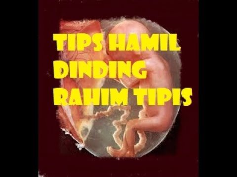Download buku Alain mobil cara menurunkan berat badan Daging adalah yang paling berguna untuk menurunkan berat badan
