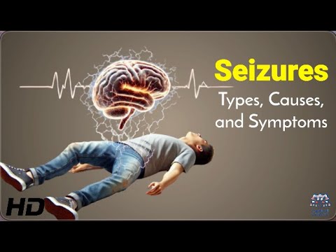 Seizures Types, Causes, and Symptoms 1080p 240930