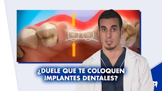 COLOCACIÓN de IMPLANTES dentales - ¿Es doloroso ¿Todo el mundo puede usarlos | #Shorts