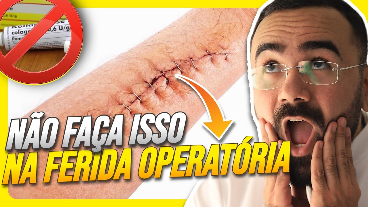 CUIDADO COM A FERIDA OPERATÓRIA! SIGO ESSES PASSOS PARA UMA BOA CICATRIZAÇÃO
