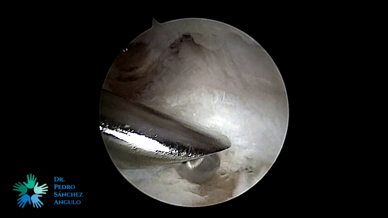 Pedro Sánchez Angulo-17