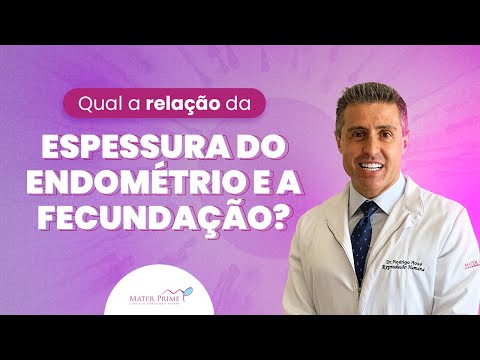 Reproduzir Vídeo