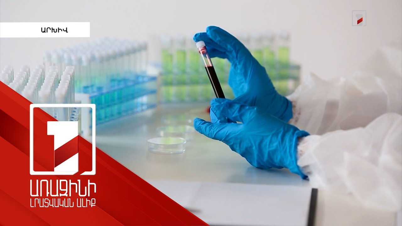 2023-ի առաջին եռամսյակում ՀՀ-ում արձանագրվել է ՁԻԱՀ-ից մահվան 19 դեպք