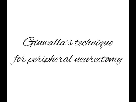 Ginwalla’s Technique For Peripheral Neurectomy |