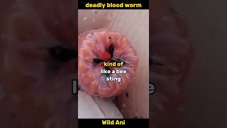 Meet the deadly Blood Worm